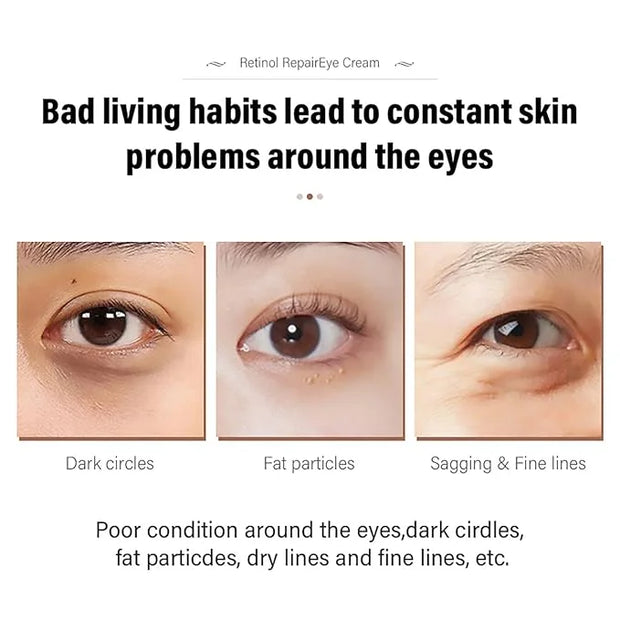 Retinol Repair Eye Cream，Reduces the appearance of dark circles，Stretch wrinkles at the corners of the eyes，moisturize and...