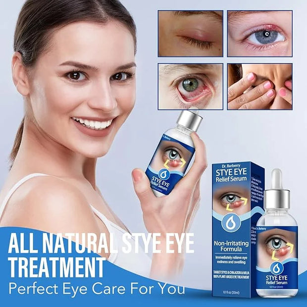 Stye Eye Treatment, Natural Stye Remover, Eye Stye Relief Serum, Premium Formula - Gentle Cleanser for Chalazion & Blephar...