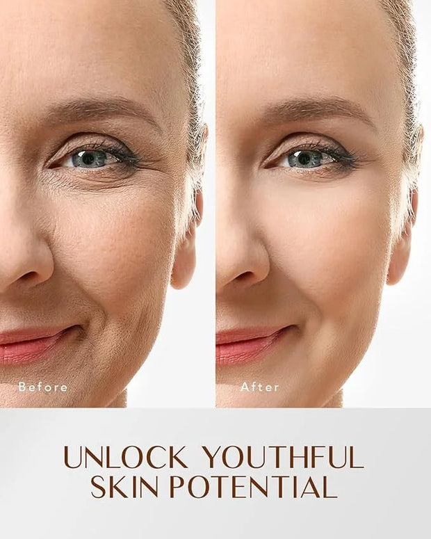 EnaSkin Retinol Collagen Face Moisturizer: Anti Aging & Wrinkle Repair Cream for Women - 7% Hyaluronic Acid Boost Hydratio...