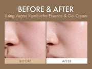 Dr.Ceuracle Vegan Kombucha Tea Gel Cream - Korean Skincare Lightweight Watery Hydrating Moisturizer with Kombucha Tea Extr...