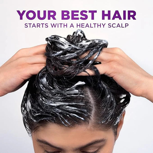 Head & Shoulders Scalp X Anti Dandruff Conditioner for Women, 5 Fl Oz Hair Treatment Reduces Hair Loss Due to Breakage and...