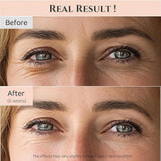 Beauty of Joseon Revive Eye Serum with Retinal Niacinamide Correction for Puffy Eye Bags Fine Lines Dark Circles Wrinkles,...