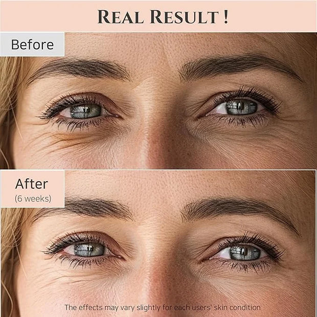 Beauty of Joseon Revive Eye Serum with Retinal Niacinamide Correction for Puffy Eye Bags Fine Lines Dark Circles Wrinkles,...