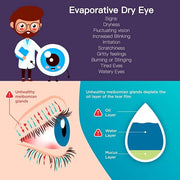 Heated Eye Mask for Dry Eyes with Temperature & Timer Remote, Eye Warm Compress Mask to Unclog Glands Eye Heating Pad for ...