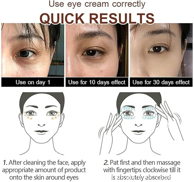 Magic Eye Cream, Instantly Remove Under Eye Bags Wrinkles Puffiness Dark Circles and Fine Lines, Anti Aging Eye Cream for ...