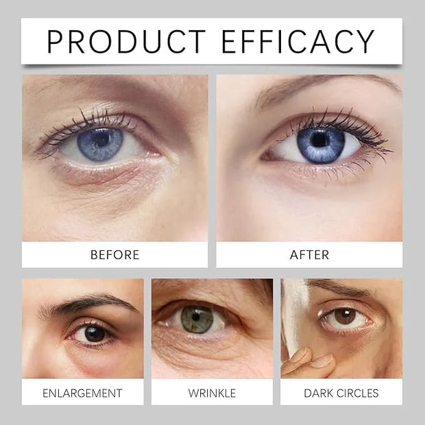 Lumibalm Erases Eye Bags within Minutes, Lumibalm for Under Eye Bags Lumibalm Eye Serum Lumibalm Stick for Under Eye Bags ...