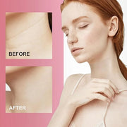Reusable Wrinkle Patches - Silicone Fusion Treatment Forehead Patches for Brow Lift, Wrinkle Smoothers, Reduce Frown Lines...