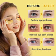 24K Gold Under Eye Patches, 100 Pairs Gold Collagen Under Eye Mask Skincare for Puffiness Eyes Dark Circles Treatments, Rr...