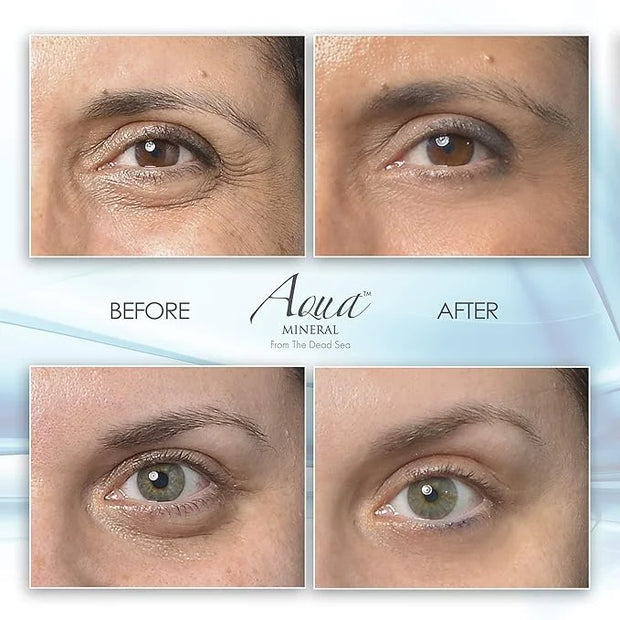 Puffy eye gel instant results