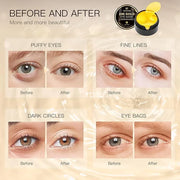 Under Eye Patches (24K Gold, 60PCS) - Under Eye Mask for Puffy Eyes, Fine lines, Dark Circles and Puffiness, Collagen Skin...