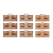 Fermentation Peptine Eye Care Cream Under Eye Cream with 8 Peptides and Niacinamide, Anti Aging Eye Cream for Wrinkles & C...