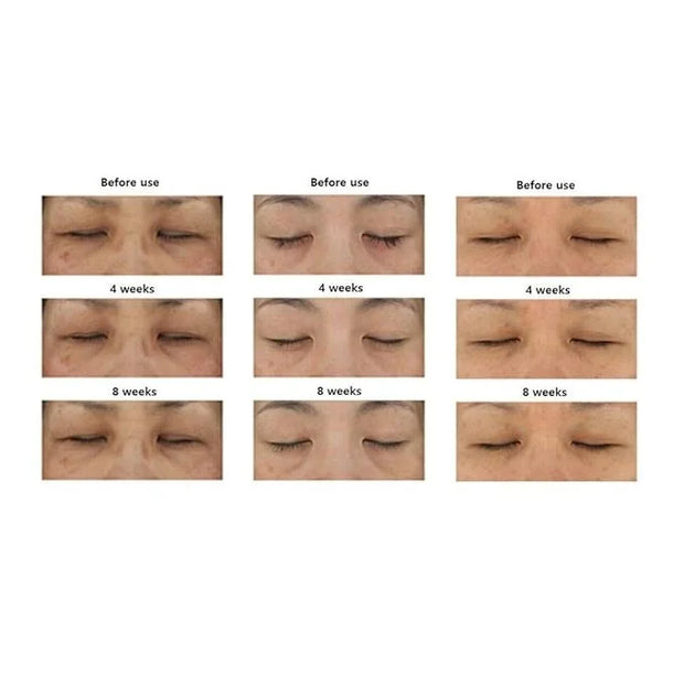 Fermentation Peptine Eye Care Cream Under Eye Cream with 8 Peptides and Niacinamide, Anti Aging Eye Cream for Wrinkles & C...