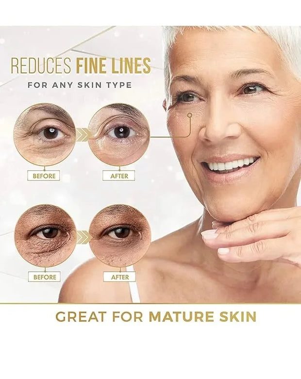 24k Gold Eye Mask Formulated for Puffy Eyes & Dark Circles for Men and Women 20 Pairs Under Eye Patches for Maximum Result...