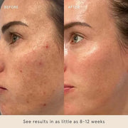 Barefaced Retinal Skin Therapy 30ml - Retinaldehyde & Bakuchiol Serum for Firming, Reducing Fine Lines & Wrinkles, Improvi...