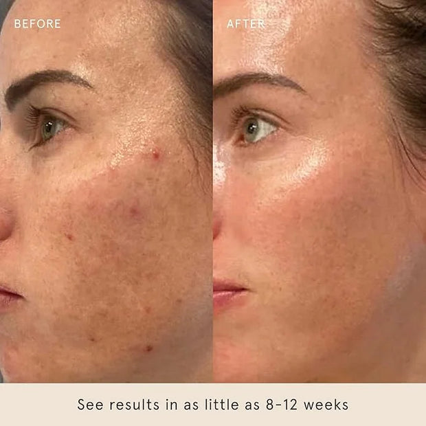 Barefaced Retinal Skin Therapy 30ml - Retinaldehyde & Bakuchiol Serum for Firming, Reducing Fine Lines & Wrinkles, Improvi...