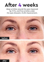 Bewants Under Eye Cream for Puffiness and Bags, Phyto Collagen Firming & Hydrating Treatment – 56.7% Vegan Collagen & Plan...