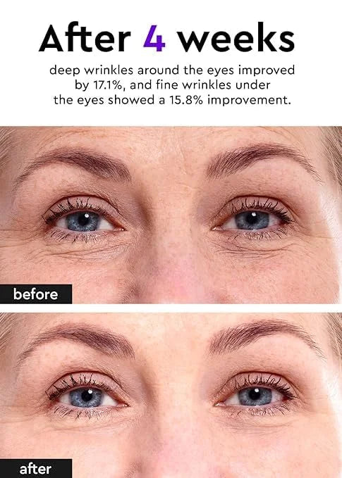 Bewants Under Eye Cream for Puffiness and Bags, Phyto Collagen Firming & Hydrating Treatment – 56.7% Vegan Collagen & Plan...