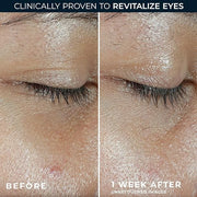 RoC Multi Correxion Revive + Glow Vitamin C Eye Balm (0.14 oz) with Retinol Eye Cream Packette - Product Image