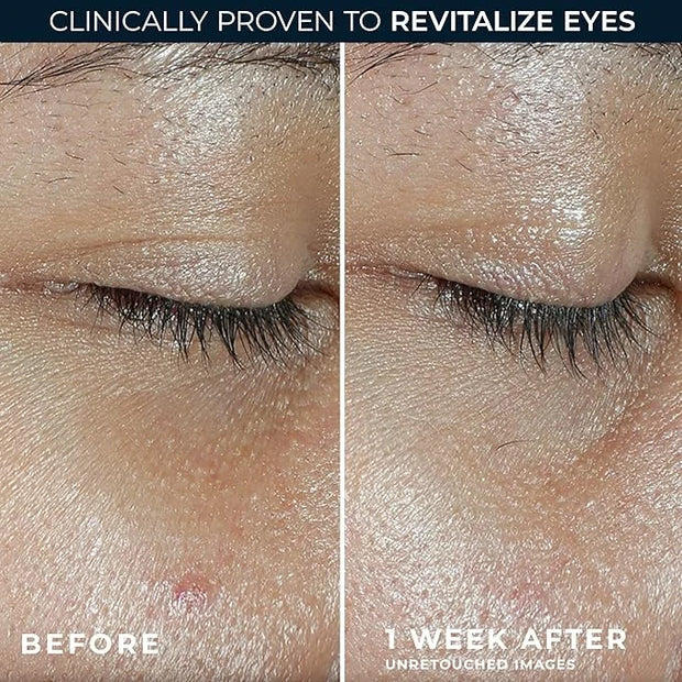 RoC Multi Correxion Revive + Glow Vitamin C Eye Balm (0.14 oz) with Retinol Eye Cream Packette - Product Image