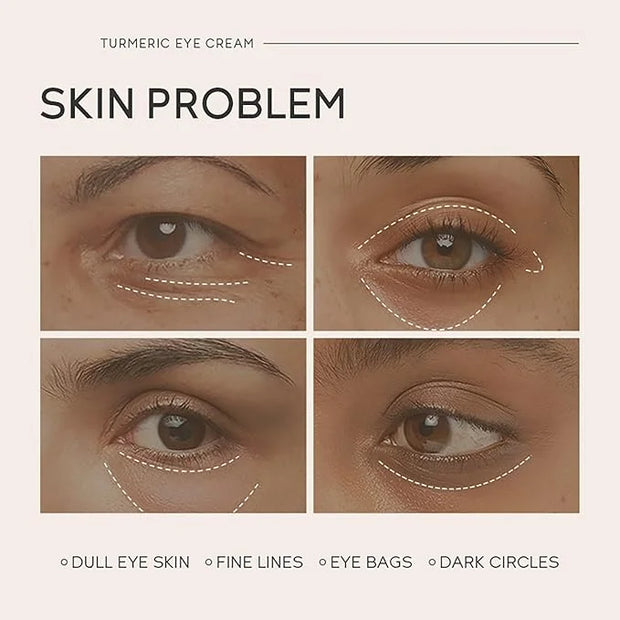 Turmeric Under Eye Cream, For Dull Eye Skin, Fine Lines, Eye Bags, Dark Circles, Eye Firming, Even Skin Tone, Hydrating, M...