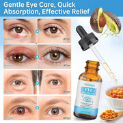 Eye Serum For Chalazion & Blepharitis Treatment, 2 PCS Chalazion Remover For Eyelid Treatment, Eyelid Serum With Avocado O...