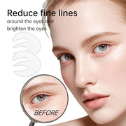 Novoy 7 Pairs Bio-Collagen Real Deep Eye Patches - 6-in-1 Retinol Overnight Eye Patches for Dark Circles, Puffiness & Wrin...