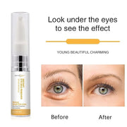 Instant Eyebag Remover Anti Aging Reduce Dark Circles, Puffiness, Under Eye Bags, Wrinkles & Fine Lines For Men & Women - ...