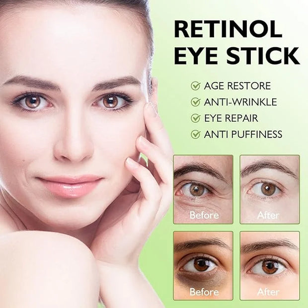 Retinol Eye Stick Retinol Eye Cream Brightening Eye Balm Reduces Fine Lines and Dark Circles Visible Results Anti-Wrinkle ...