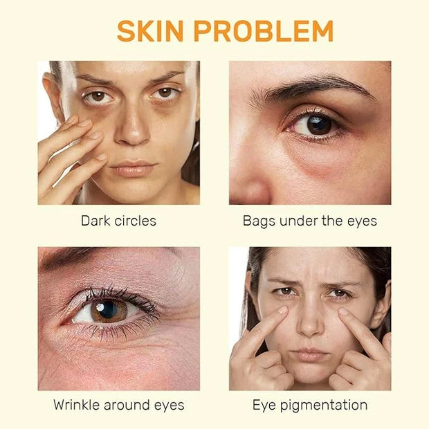 Vitamin C Eye Cream For Dark Circles, Under Eye Cream Anti Wrinkles For Reduce Puffiness And Bags Fine Lines, Wrinkles, Hy...