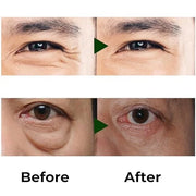 Combo exclusively for men Abera Eye Roller Serum With Mint Essence - Abera Armpit Roller - Product Image