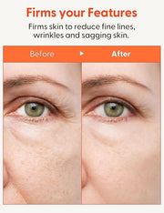 It'S SKIN Collagen Nutrition Emulsion + 5.07 fl.oz, Boosts Collagen and Adenosine for Face Lift Helps Fine Lines Supports ...