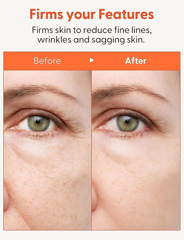 It'S SKIN Collagen Nutrition Emulsion + 5.07 fl.oz, Boosts Collagen and Adenosine for Face Lift Helps Fine Lines Supports ...