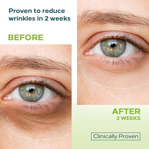 0.68 OZ Dual Eye Cream – Anti-Aging Blend with Stem Cells, Retinol & Peptides – Tightens, Brightens, and Smooths - Product...