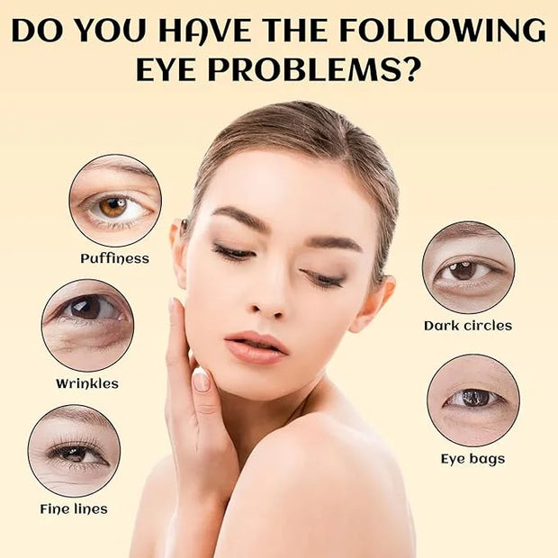 2PCS Eye Balm For Under Eye Bags, Turmeric Eye Bag Cream For Dark Circles, Dark Circles Under Eye Treatment, Eye Balm For ...