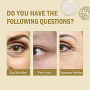Under Eye Patches for Dark Circles,Puffy Eyes,20 Pairs Face Masks SkinCare With Collagen and Retinol for Anti wrinkles Smo...