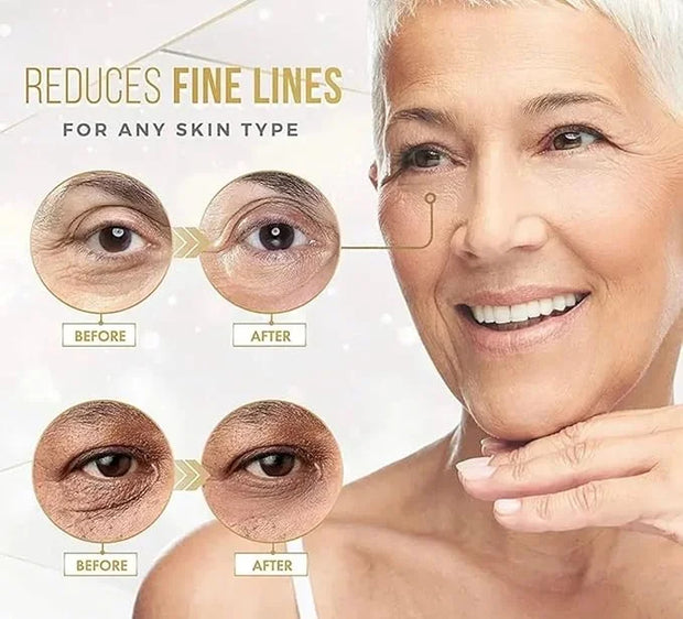 24k Gold Eye Treatment Masks With Collagen - Product Image