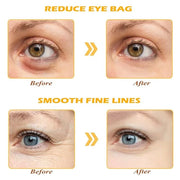 24K Gold Eye Mask, 30 Pairs Under Eye Masks for Dark Circles and Puffiness Treatment, Under Eye Patches for Puffy Eyes and...