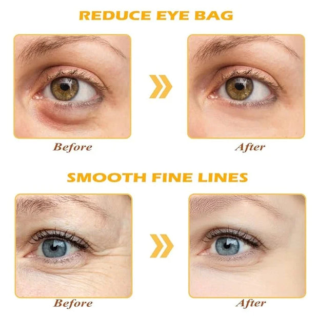 24K Gold Eye Mask, 30 Pairs Under Eye Masks for Dark Circles and Puffiness Treatment, Under Eye Patches for Puffy Eyes and...