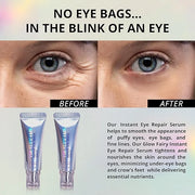 Eye Repair Serum (10g) – Under Eye Cream for Dark Circles, Puffiness, Fine Lines & Crow's Feet – Hydrate, Moisturize & Rev...