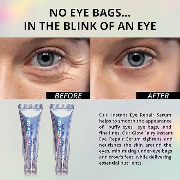 Eye Repair Serum (10g) – Under Eye Cream for Dark Circles, Puffiness, Fine Lines & Crow's Feet – Hydrate, Moisturize & Rev...