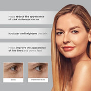 Glytone Age-Defying PHA+ Renewing Eye Cream for Wrinkles| Anti aging Under Eye Cream with Hyaluronic Acid Peptides| Target...