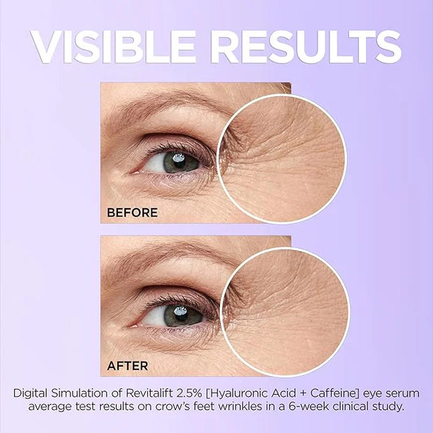 L'Oreal Paris Revitalift Hyaluronic Acid + Caffeine Hydrating Eye Serum for Dark Circles, Fragrance Free .67 fl. oz + Mois...