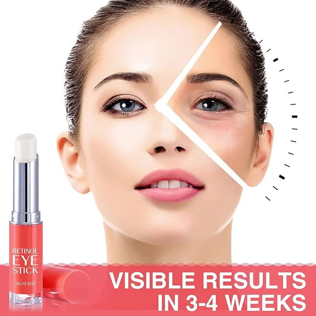 Retinol Eye Stick, Retinol Eye Cream, Under Eye Brightener Stick for Dark Circles, Eye Cream Anti Aging, Eyes Treatment Pr...