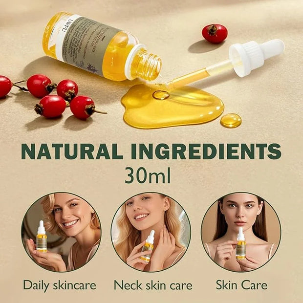 Rosehip Oil For Face & Body - Pure Organic Cold-Pressed Moisturizer-30ML - Product Image
