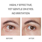 VGO Eye Cream 2% Pro-Xylane Eye Repair Cream for Dark Circles & Puffiness Under Eyes, Pro Xylane + 6D Hyaluronic Acid to F...
