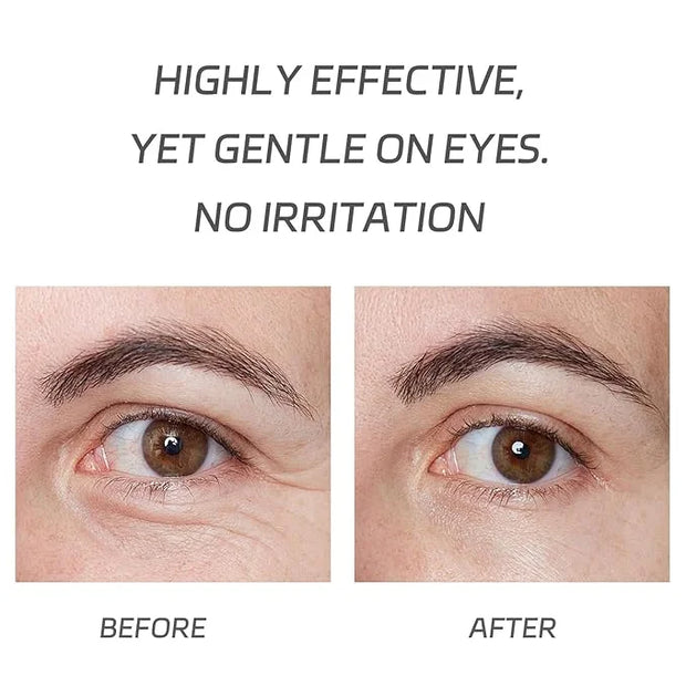 VGO Eye Cream 2% Pro-Xylane Eye Repair Cream for Dark Circles & Puffiness Under Eyes, Pro Xylane + 6D Hyaluronic Acid to F...