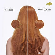Dove Shampoo Intensive Repair for Damaged Hair with Bio-Protein Care Technology and Amino Serum 28 Fl Oz - Product Image
