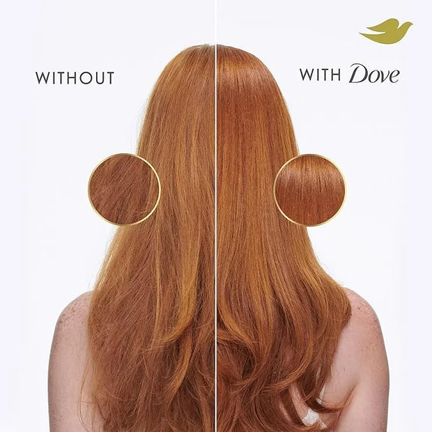 Dove Shampoo Intensive Repair for Damaged Hair with Bio-Protein Care Technology and Amino Serum 28 Fl Oz - Product Image