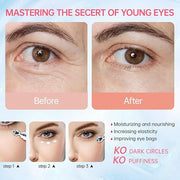 Instant Reduction of eye bags-Retinol Eye Cream Dark circles,Relieves Dark Circles And Puffiness, Youth Eye Cream: Anti-Wr...