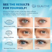 Under Eye Patches for Puffy Eyes: 60 Count Retinol Collagen Eye Gels Pads - Eye Skin Treatment Mask for Dark Circles, Wrin...